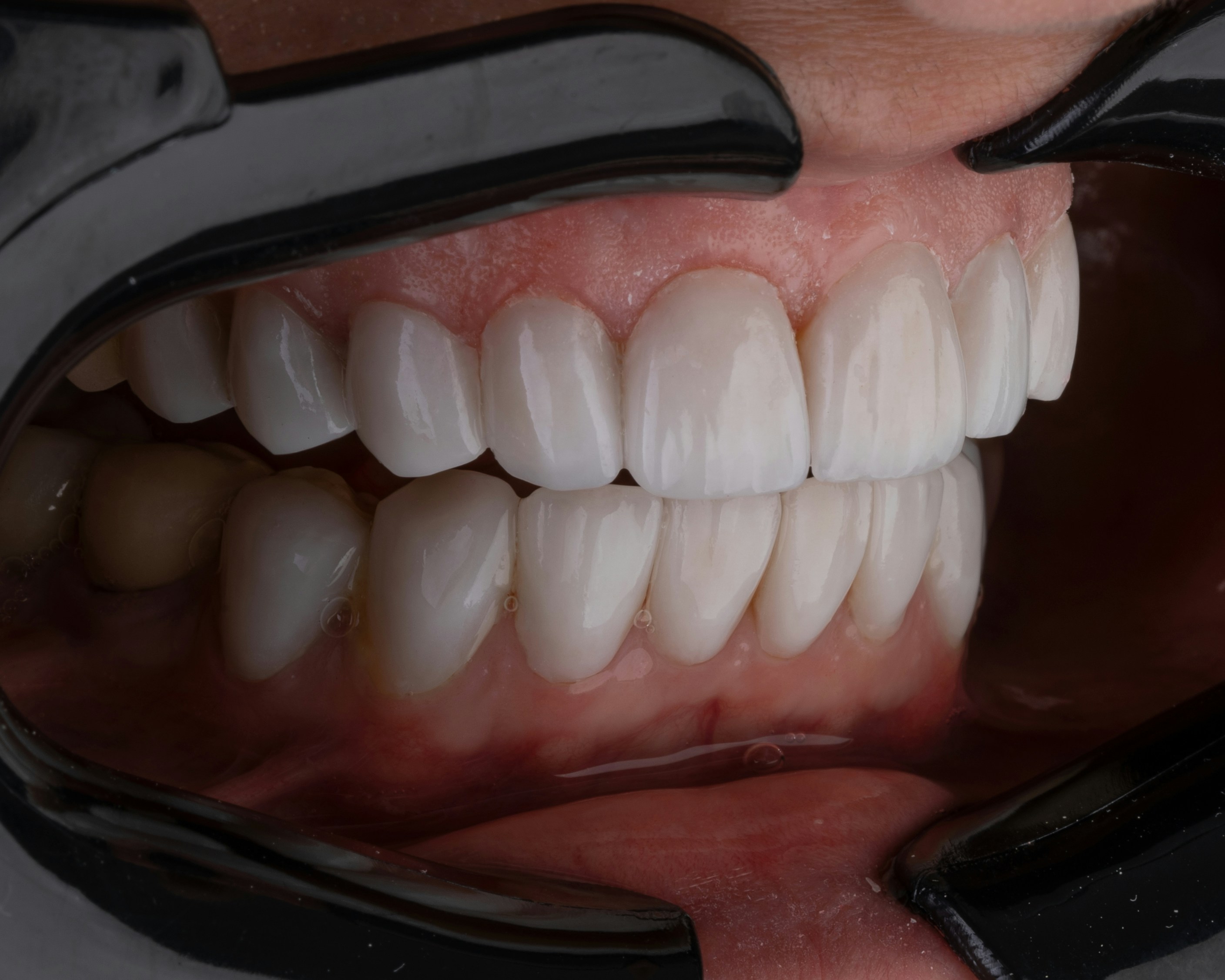 Dental Unit